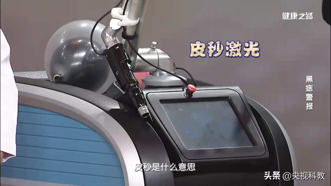 黑痣很容易恶变吗,身上黑痣出现什么状况有癌变发生