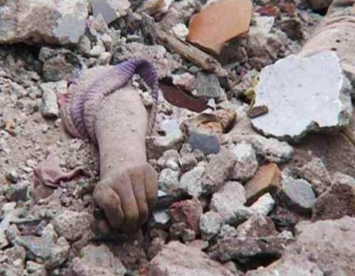 地震中失去双腿的李应霞,地震李应霞失去双腿