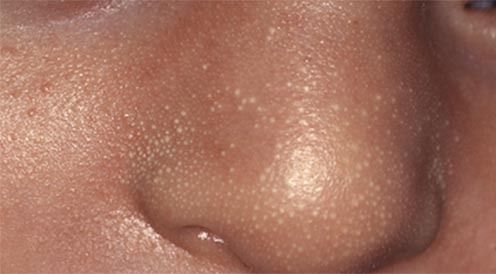 刚出生的宝宝怎样的表现是健康的,新生儿出生1-6个月常见问题