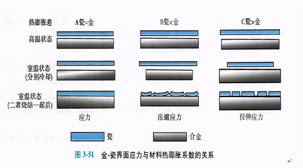 口腔金属冠与全瓷冠的区别,牙科医生讲义