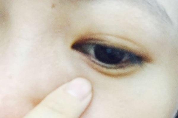 左眼皮跳财右眼跳灾是真的吗,有人说左眼跳财右眼跳灾是真的吗