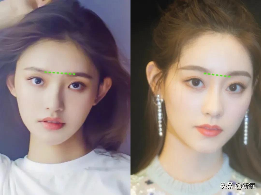 做双眼皮的姐妹还是要慎重,姐妹们你们割双眼皮多少钱