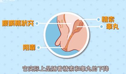 宝宝疝气怎么手法复位,宝宝疝气什么时候动手术最佳
