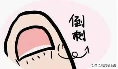 宝宝手上有倒刺应该怎么解决,宝宝手上长倒刺用什么药