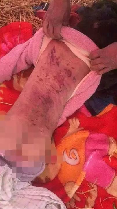 河南虐童事件反思,河南虐童案件最近进展