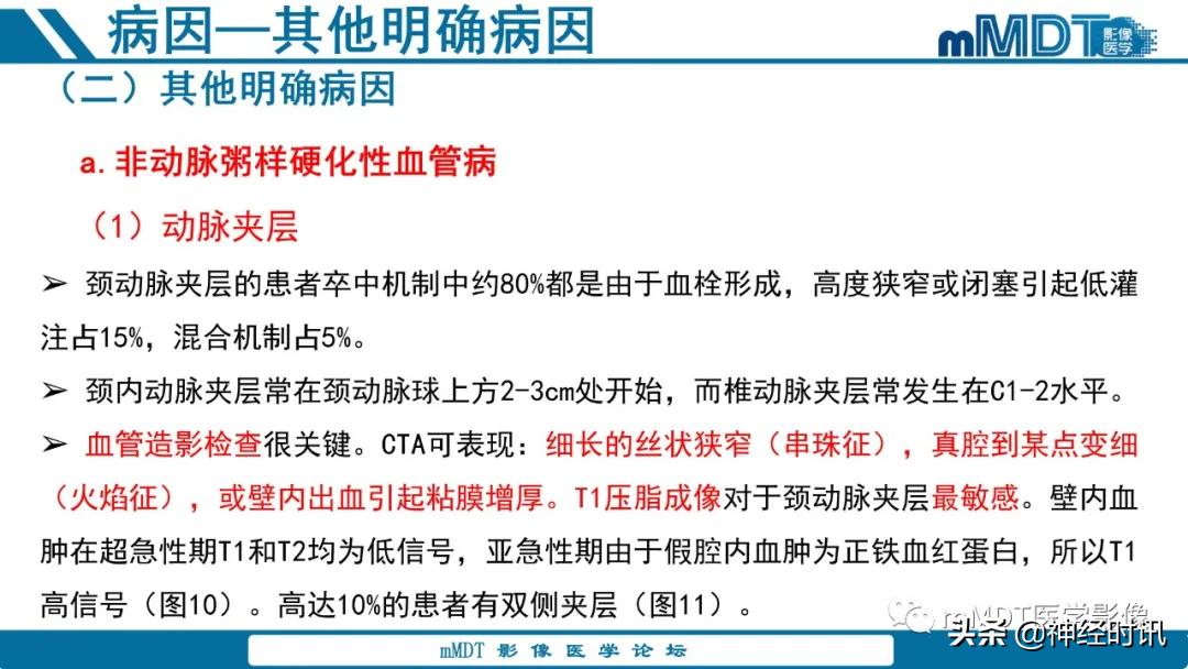 缺血性脑卒中护理课件,缺血性脑卒中讲课ppt