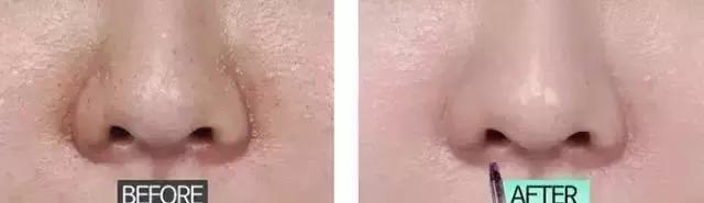 洗脸清洗黑头,洗脸清洁去粉刺