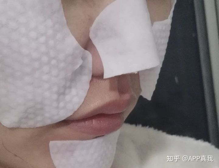 刷酸的作用效果持续多久,刷酸一次效果能维持多久