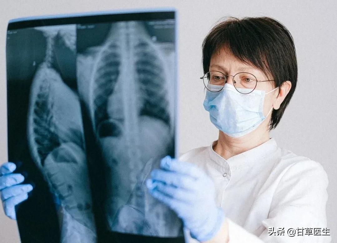 痰黄吃什么祛痰止咳,痰多用什么秘方治疗最佳