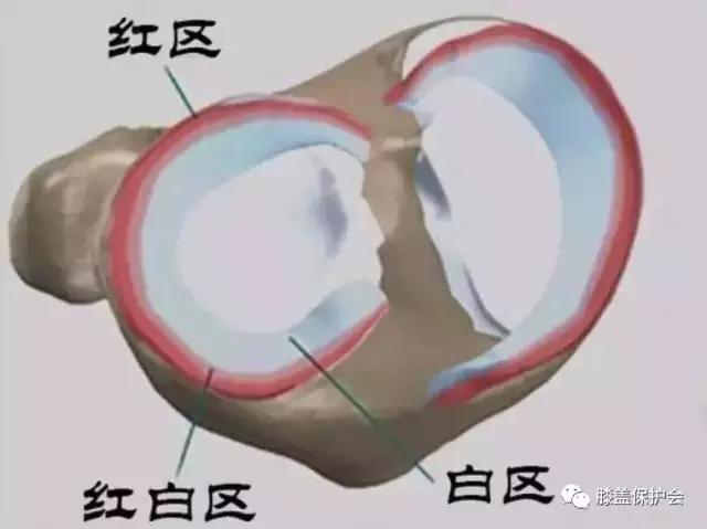 半月板受伤的理由,半月板最怕的动作别再做了