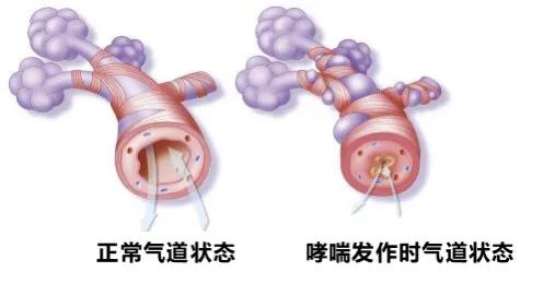 阜新矿总院呼吸内科,矿总院呼吸内科专家