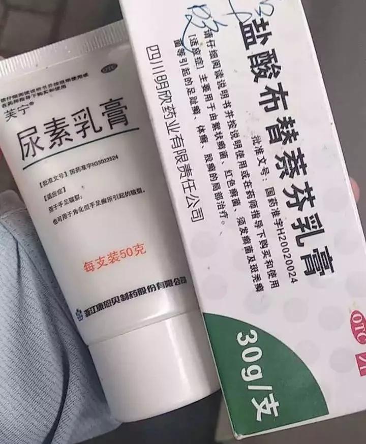 手上脱皮是什么真菌,手上脱皮真菌感染抹什么药膏好