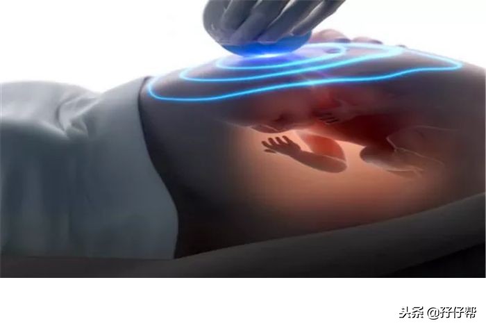 12周双胎,孕12周孕妈妈会有什么感觉