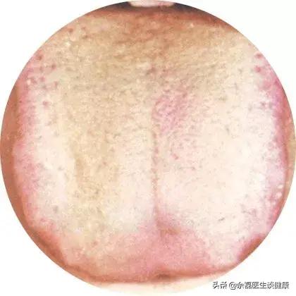 胃病最明显的一个征兆自测,胃病症状及养胃知识点