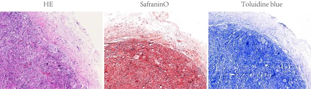 深圳先进院研发可注射活体生物材料修复半月板损伤并抑制关节退变