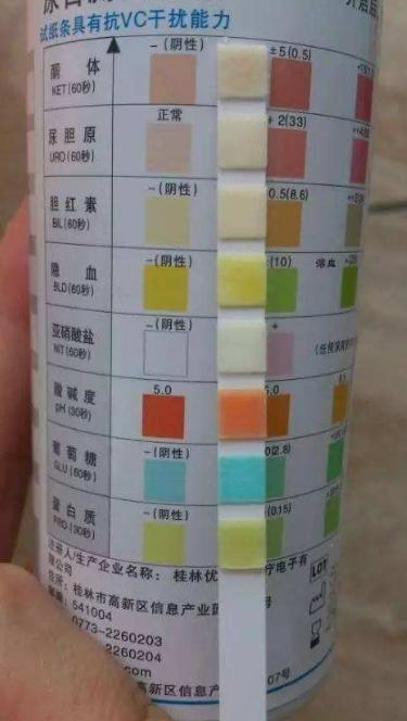 尿液白细胞160多严重吗,尿里白细胞115说明哪里有病