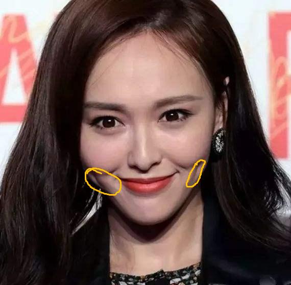 张歆艺用的什么填充脸部,张歆艺填充脸部前后对比