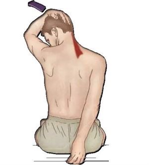 如何解决含胸驼背问题,你含胸驼背的样子