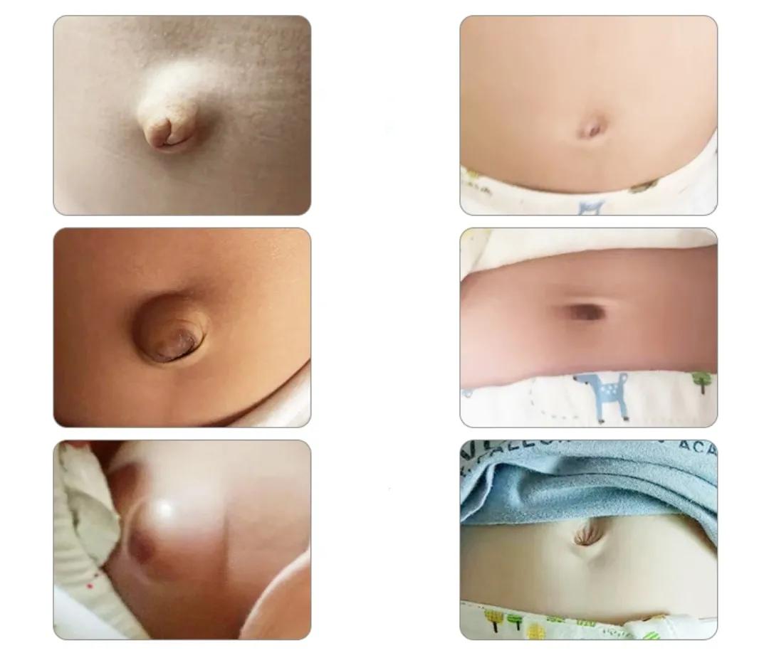 新生儿常见的皮肤问题,新生儿心脏血管常见问题