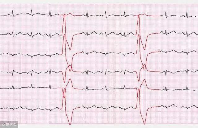 心脏经常抽是怎么回事,经常长出气是咋回事