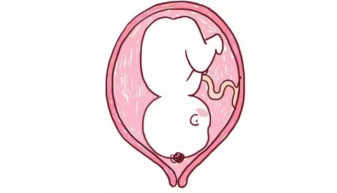 孕中期内脏被挤到哪了,怀孕后内脏都被挤到哪里去了