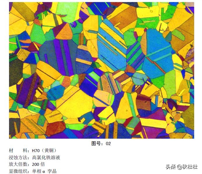 马氏体和奥氏体金相图片,马氏体和珠光体金相区别