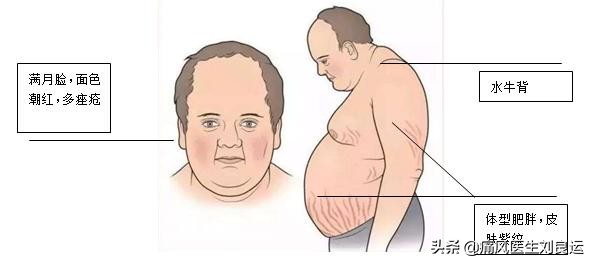 心血管疾病患者痛风吃什么药,痛风吃什么西药能快速止痛降尿酸