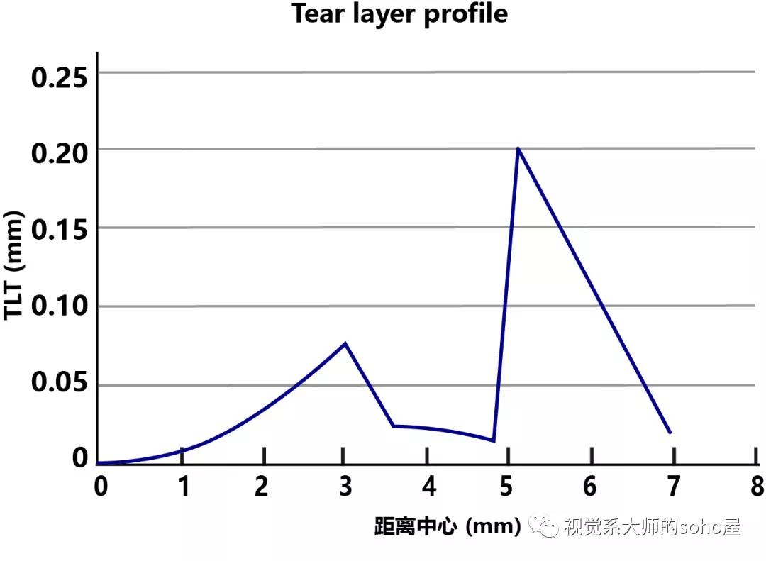视光方面的知识,视光眼科科普