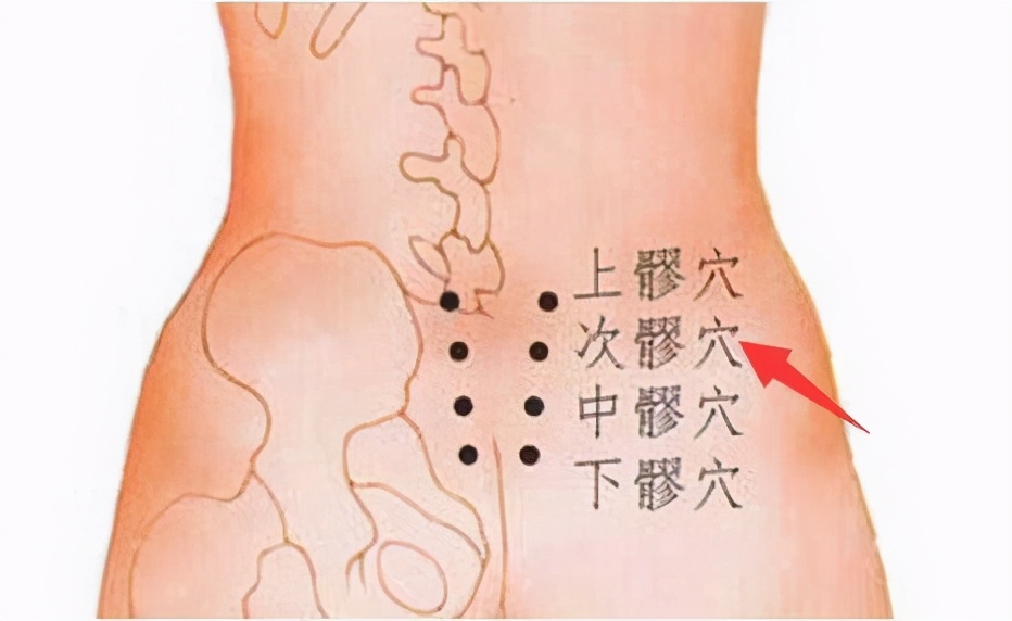 会阴神经痛针灸治疗穴位,康复理疗坐骨神经痛