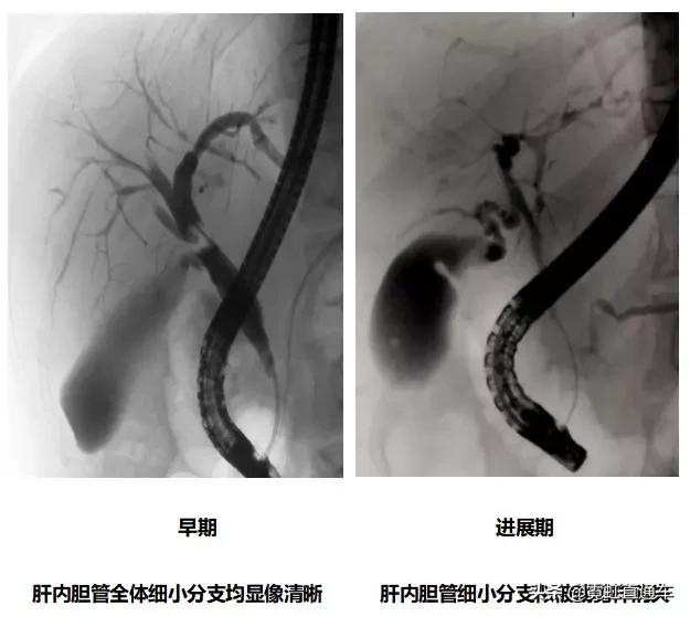 ps中疑难杂症,ps疑难杂症