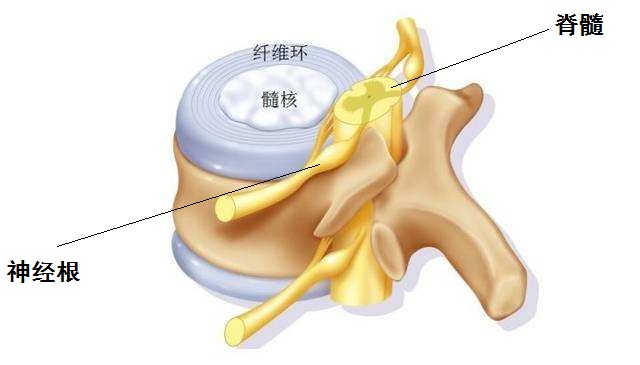 椎间盘突出压迫脊髓神经临床经验,颈椎间盘突出压迫脊髓有哪些症状