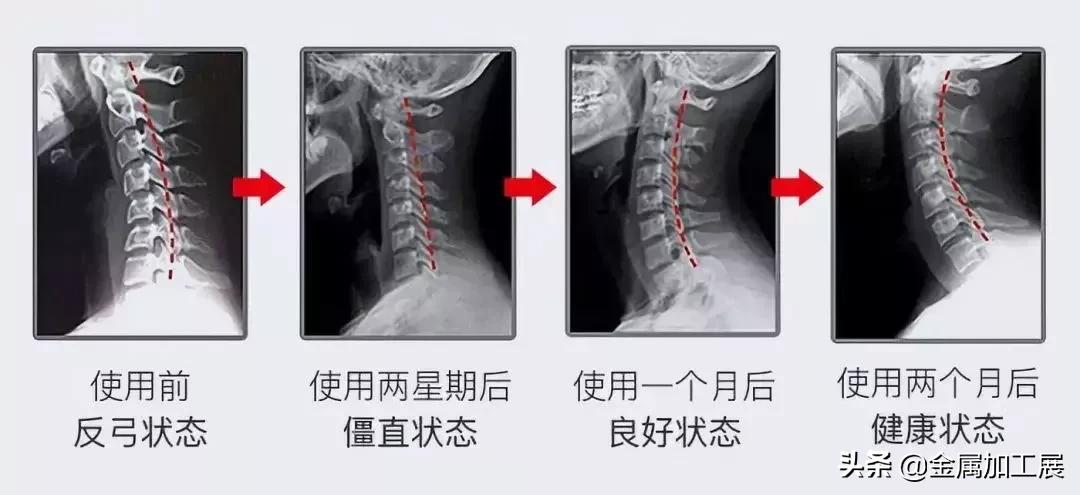 矫正颈椎变形的颈椎枕,日本颈椎专用枕的热敷按摩枕头