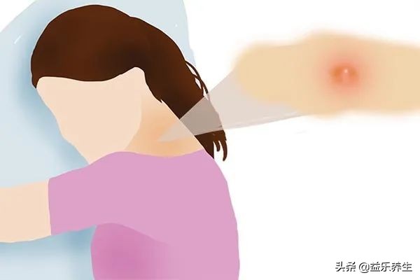 50岁男人脖子上长小肉粒怎么回事,脖子两侧长小肉粒是什么原因