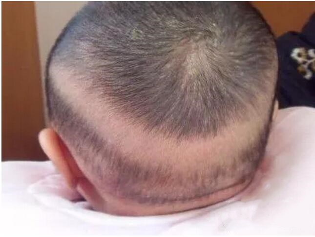 新生宝宝最常见的问题,新生宝宝必须注意的八件事