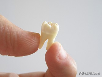 拔完智齿吃东西有什么需要注意的,横向阻生智齿有什么忌口