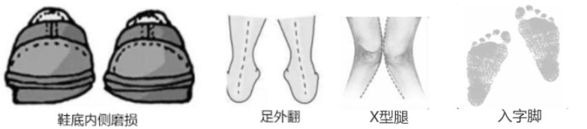 走路费鞋后跟,如何通过鞋底判断走路姿势