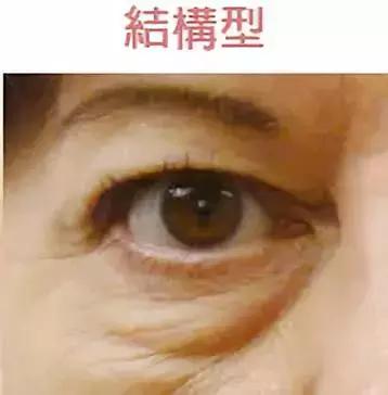 眼部精华和眼霜的正确使用方法,眼部精华眼霜眼膜的正确使用顺序