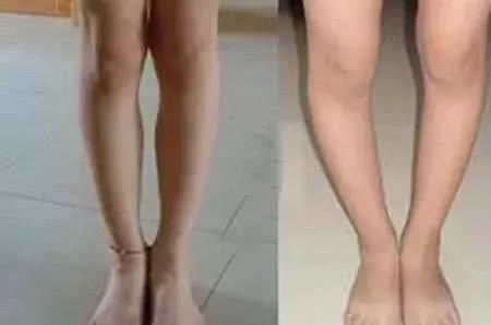 跷二郎腿影响生殖健康？吓得我赶紧乖巧坐直