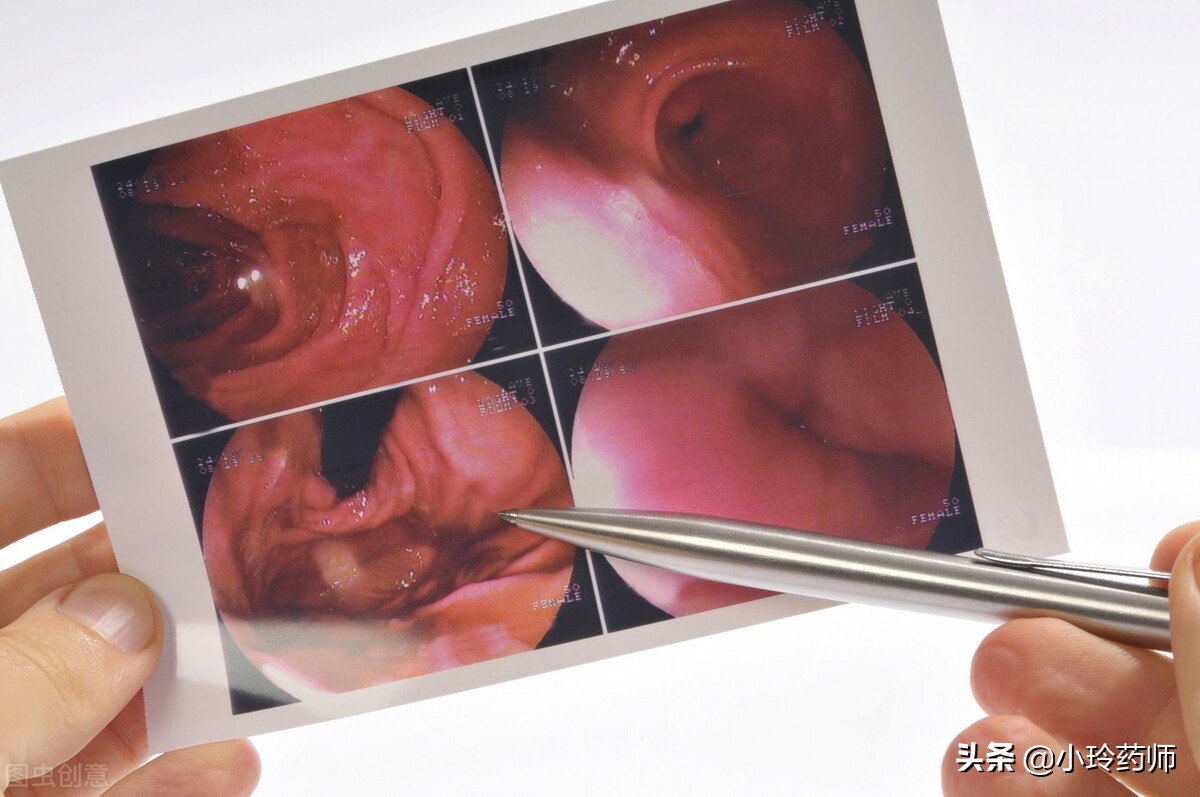 胃癌筛查三项超标,胃癌晚期老是恶心再做胃镜能行吗