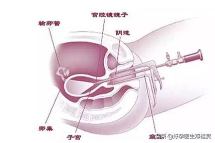 备孕胸透的危害有多大,纵隔子宫怀孕需要注意什么