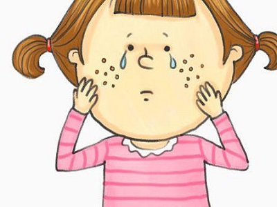 嘴唇周围长痘原因是什么怎么治疗,嘴巴周围长痘的解决方法青春期