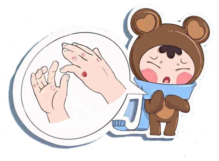 冻疮反复怎么治才可以除根,冻疮反复发作怎么根除