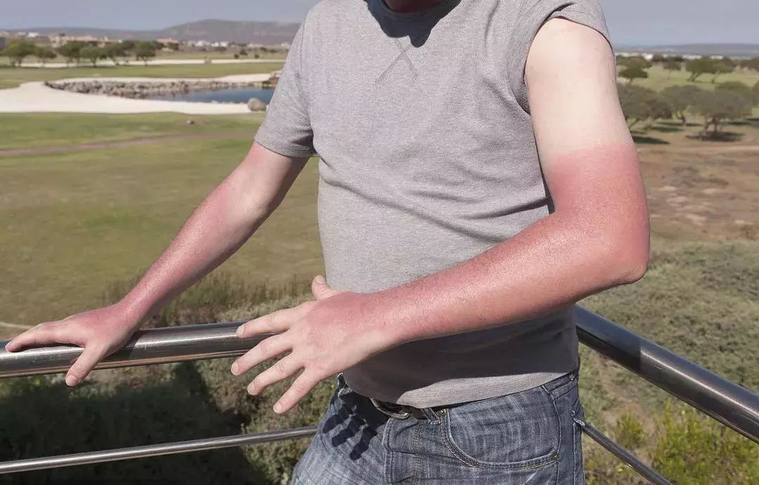 蕉下防晒冰袖哪个颜色最好看,蕉下防晒冰袖加长款