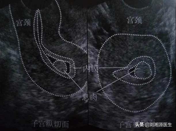 免疫不良妊娠可以通过中药治疗吗,免疫相关不良妊娠答疑解惑