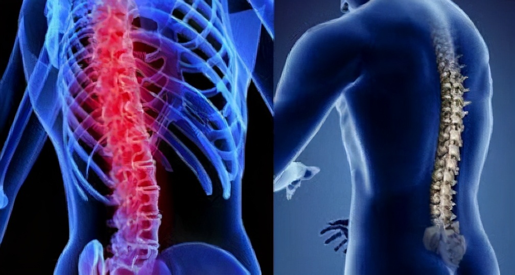 骨髓炎有什么预兆,骨髓炎什么症状能治好吗