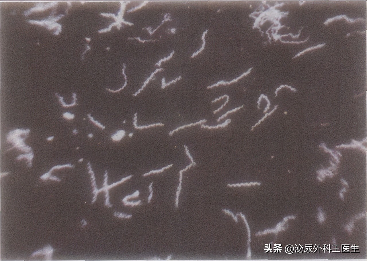 性病“梅毒”是如何横扫世界?