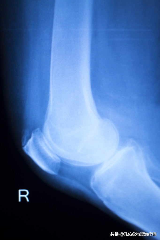 膝疼的最佳治疗方法,如何克服膝痛