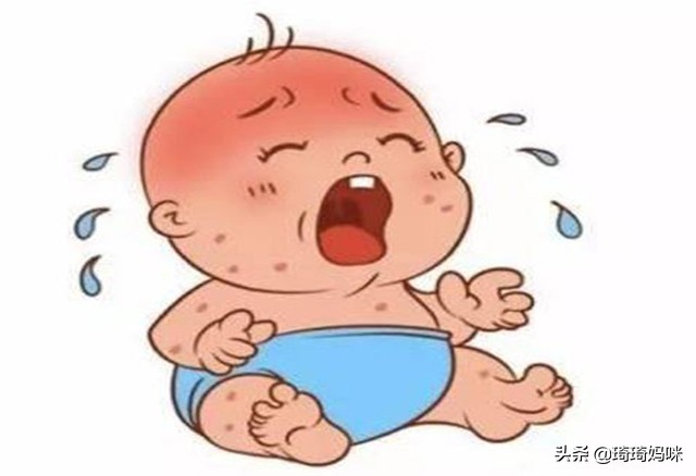 宝宝长湿疹会有哪些危害?长湿疹后如何护理?答案在这,看过来