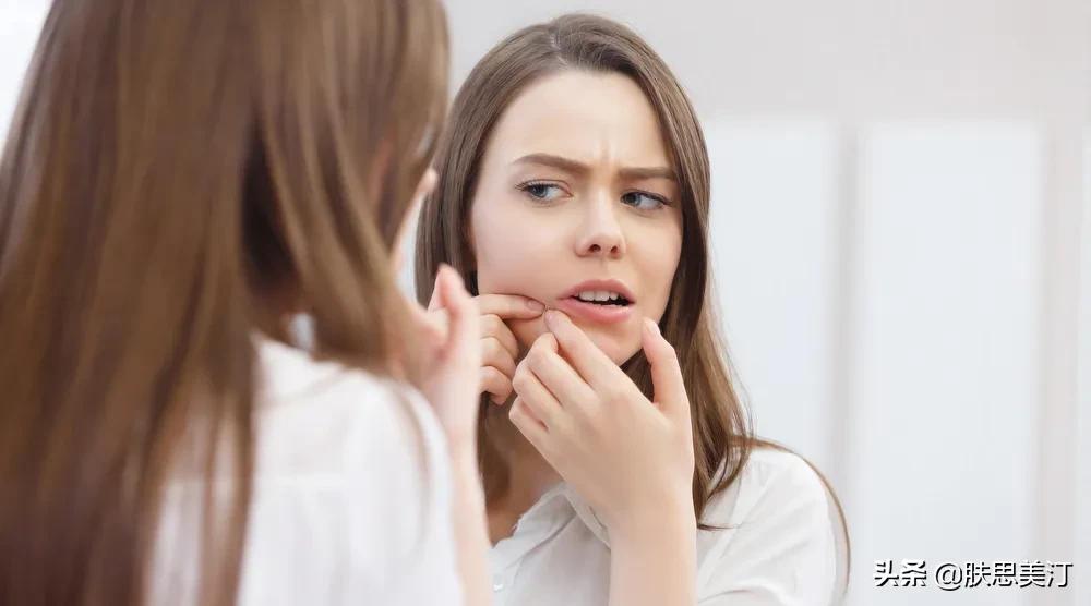 战痘消好用吗,战痘多年毫无成效你真的了解它吗