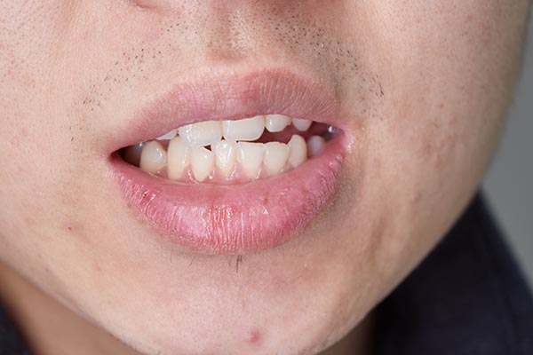 如果一辈子不洗头会怎么样,如果一辈子不洗牙会怎样